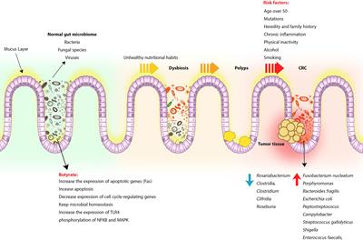 Does the Microbiota Composition Influence the Efficacy of Colorectal Cancer Immunotherapy?